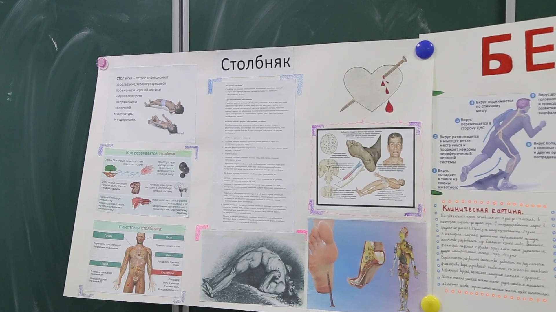 Специфическая хирургическая инфекция